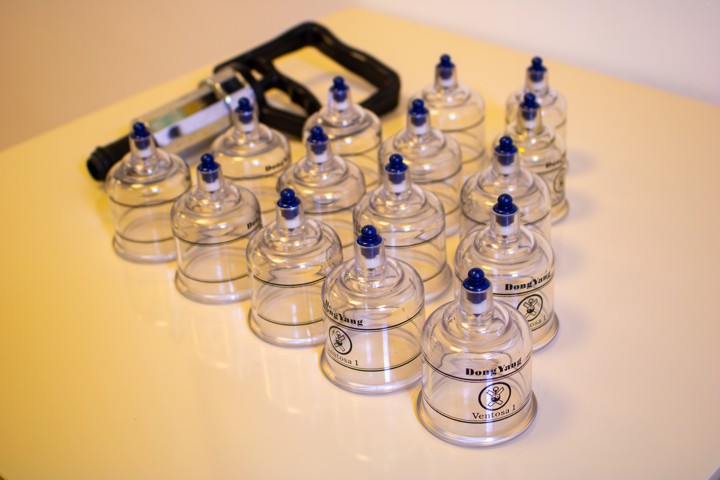 Foto 15 Ventosoterapia.jpg